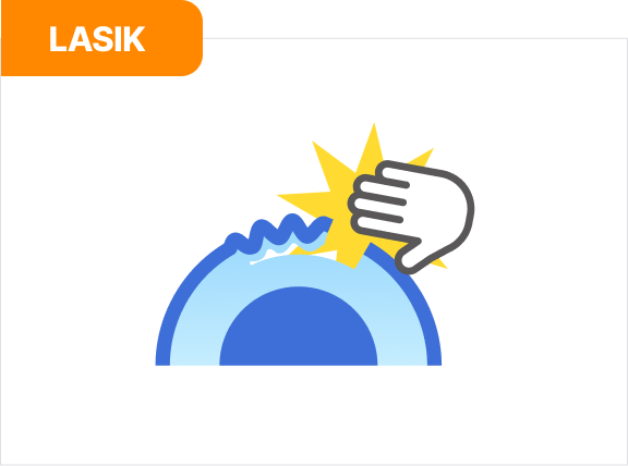 라식 | LASIK